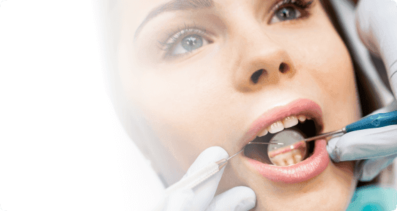 Diş Beyazlatma görseli